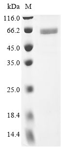 Recombinant Human N-myc proto-oncogene protein (MYCN)