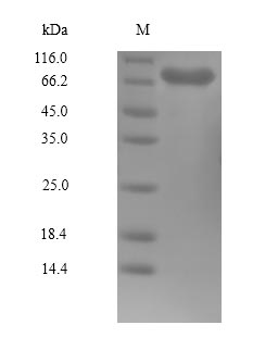 Recombinant Human Serine/threonine-protein kinase PLK1 (PLK1)
