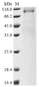 Recombinant Human DNA polymerase theta (POLQ), partial