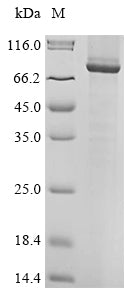Recombinant Human Receptor-type tyrosine-protein phosphatase T (PTPRT), partial
