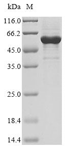 Recombinant Human Nuclear receptor ROR-alpha (RORA)