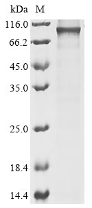 Recombinant Mouse Ribosomal protein S6 kinase alpha-4 (Rps6ka4)