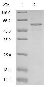 Recombinant Human Pulmonary surfactant-associated protein B (SFTPB)
