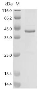 Recombinant Human Pendrin (SLC26A4), partial