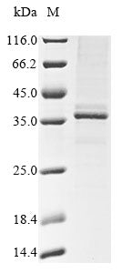 Recombinant Mouse Beta-tectorin (Tectb)