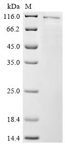 Recombinant Human DNA topoisomerase 1 (TOP1)