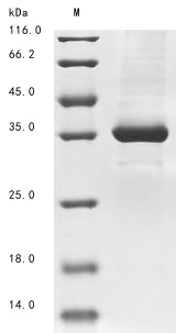 Recombinant Zaire ebolavirus Super small secreted glycoprotein (GP)