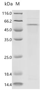 Recombinant Human herpesvirus 1 Capsid vertex component 1 (CVC1), partial