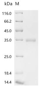 Recombinant Plasmodium falciparum Thrombospondin-related anonymous protein (TRAP), partial