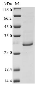 Recombinant Epstein-Barr virus Secreted protein BARF1 (BARF1)