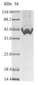 Recombinant Measles virus Nucleoprotein (N), partial