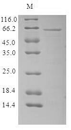 Recombinant Human parvovirus B19 Minor capsid protein VP1, partial