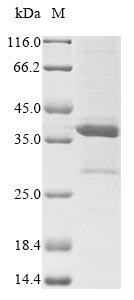 Recombinant Human respiratory syncytial virus A Major surface glycoprotein G (G), partial