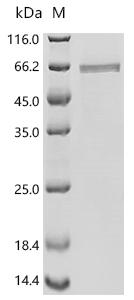 Recombinant Influenza A virus Nucleoprotein (NP)