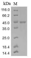 Recombinant Measles virus Nucleoprotein (N), partial