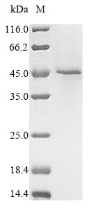 Recombinant Human Receptor-interacting serine/threonine-protein kinase 1 (RIPK1), partial