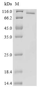 Recombinant Human Origin recognition complex subunit 1 (ORC1)(R297E,S450Y,T593Y,R846E)