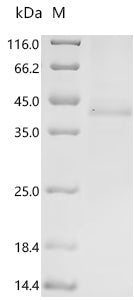 Recombinant Human herpesvirus 6A Immediate-early protein 1 (U90/U89), partial