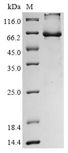 Recombinant Human Endogenous retrovirus group K member 6 Env polyprotein (ERVK-6), partial