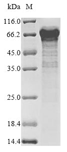 Recombinant Rat Probable E3 ubiquitin-protein ligase makorin-3 (Mkrn3)