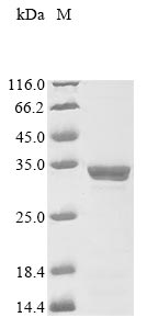 Recombinant Human metapneumovirus Matrix protein (M)