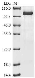 Recombinant Human E3 ubiquitin-protein ligase RNF168 (RNF168)