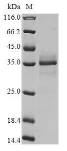 Recombinant Mouse NAD-dependent protein deacylase sirtuin-5, mitochondrial (Sirt5)