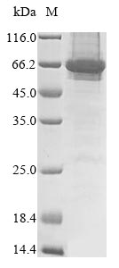 Recombinant Human Extracellular serine/threonine protein kinase FAM20C (FAM20C)