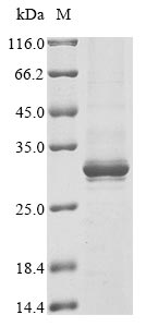 Recombinant Human Alpha-protein kinase 1 (ALPK1), partial