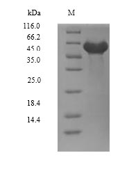 Recombinant Human Dual specificity tyrosine-phosphorylation-regulated kinase 2 (DYRK2), partial