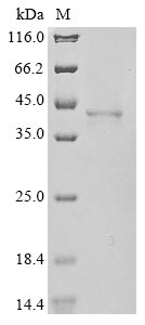 Recombinant Human ADP-ribose glycohydrolase MACROD1 (MACROD1)