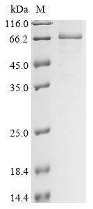 Recombinant Human Insulin-like growth factor 2 mRNA-binding protein 1 (IGF2BP1)