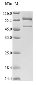 Recombinant Mouse Peroxisomal acyl-coenzyme A oxidase 1 (Acox1)