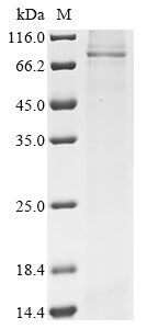 Recombinant Human ATP-binding cassette sub-family D member 3 (ABCD3)