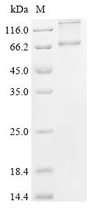 Recombinant Human C-C chemokine receptor type 3 (CCR3)