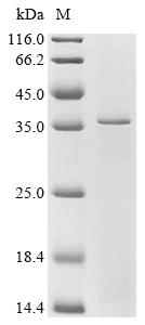 Recombinant Human Etoposide-induced protein 2.4 homolog (EI24)