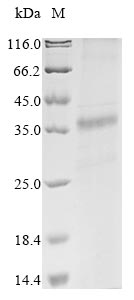 Recombinant Mouse Hereditary hemochromatosis protein homolog (Hfe)