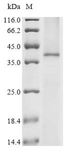 Recombinant Human C-X-C chemokine receptor type 1 (CXCR1)
