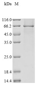 Recombinant Human Acetolactate synthase-like protein (ILVBL)