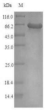 Recombinant Human ATP-sensitive inward rectifier potassium channel 10 (KCNJ10)