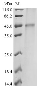 Recombinant Human ATP-sensitive inward rectifier potassium channel 10 (KCNJ10)