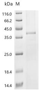 Recombinant Mouse Hepatic sodium/bile acid cotransporter (Slc10a1)