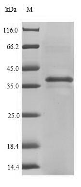 Recombinant Mouse Beta-tectorin (Tectb)