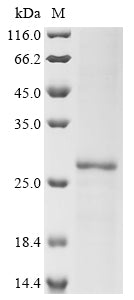 Recombinant Human Uroplakin-2 (UPK2)