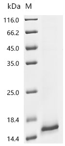 Recombinant Human Uroplakin-2 (UPK2)