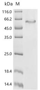 Recombinant Mycobacterium tuberculosis Probable transport accessory protein MmpS3 (mmpS3)