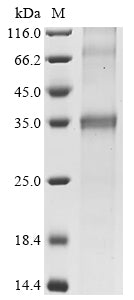Recombinant Human Urea transporter (SLC14A1)