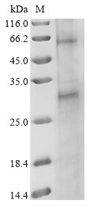 Recombinant Psoroptes ovis NADH dehydrogenase subunit 2 (nad2)