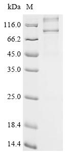 Recombinant Plasmodium falciparum Rhomboid-like protease (PF3D7_0506900)