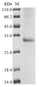 Recombinant Rat Mitochondrial glutamate carrier 2 (Slc25a18)